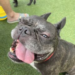 続々　右肘頭骨折　緊急入院　手術　